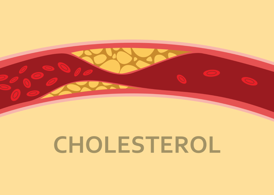 Cara Menurunkan Kolesterol: Tips, Diet, dan Informasi Kesehatan - Featured Image